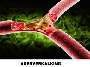 1Artikel Locomotorius voor DBS, editie van 2 februari 2019 te zout eten1