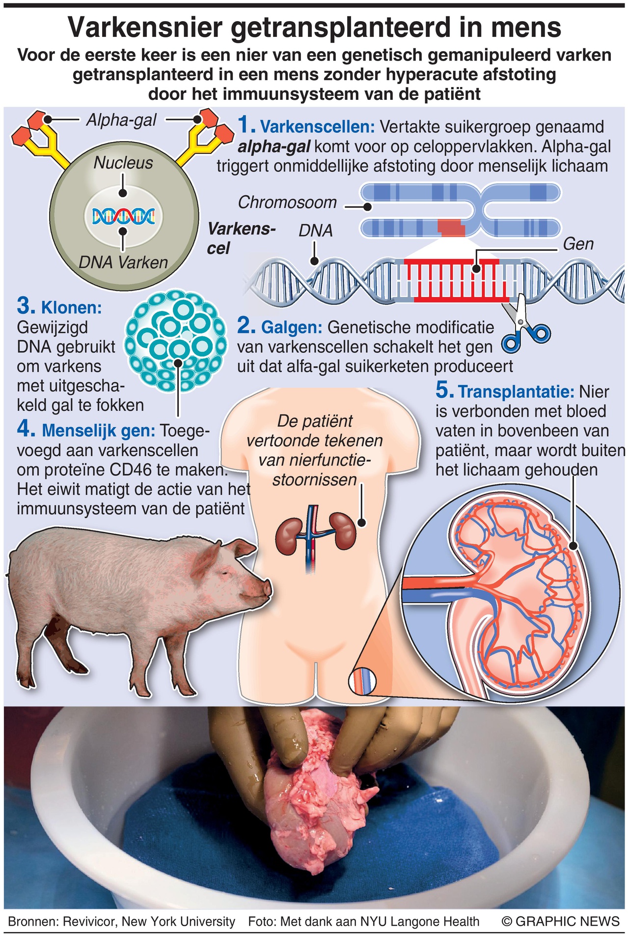 Trasplante de un riñón de cerdo modificado genéticamente en humanos por primera vez … – Dagblad Suriname 2021